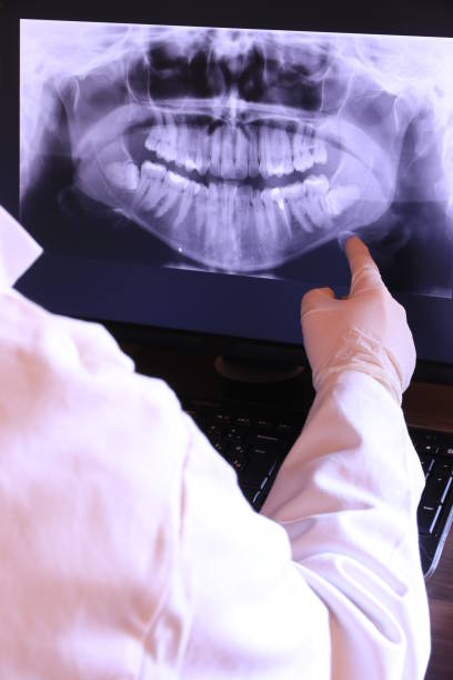 Best Emergency Dental Extractions in Aurora, IN
